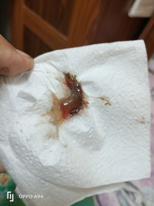 อาการใกล้คลอด