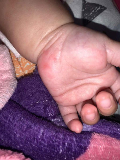 Ini eksim atau apa ya?