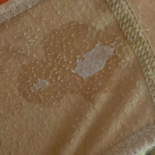 Usia kandungan 28w4d