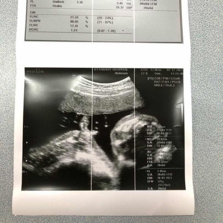 ใกล้จะ 4 เดือนเเล้ววว