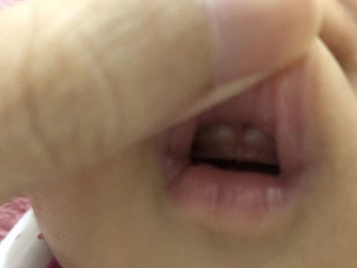 ฟันลูกขึ้นตอนกี่เดือนค่ะ