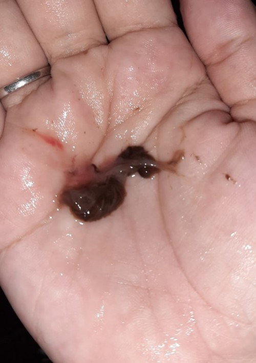 38weeks IE KAHAPON 2-3CM 
TODAY NILABASAN PO AKO NYAN.