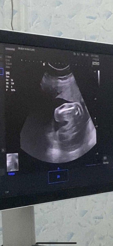 ผู้หญิงกี่เปอร์เซ็นต์คะ