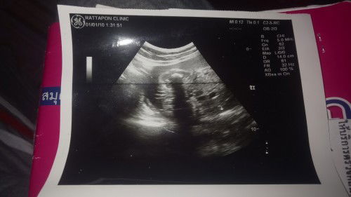 28w5dน้ำหนักเท่าไหร่บ้างคะ