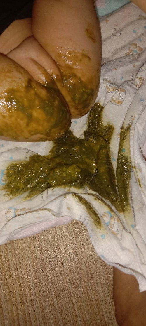 สอบถามแม่ๆหน่อยค่ะลูกกินนมผงค่ะกินมาตั้งแต่ช่วง1เดือนกว่าค่ะตอนแรกที่กินน้องถ่ายปกติค่ะแม่