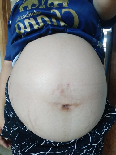 8/12/65 📌 35+1 วีค