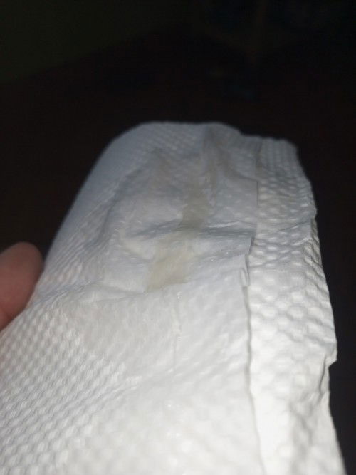 มีอาการท้องปั่น ท้องแข็ง น้องดิ้นเหมือนโก้งตัวอย่างเดียว