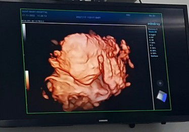 อยากดูภาพลูกๆของคุณแม่จังเลยคะ🥰🥰