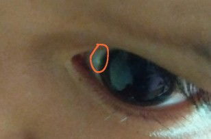 Mohon pencerahannya bunda