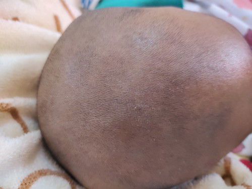 ลูกน้อย2เดือน