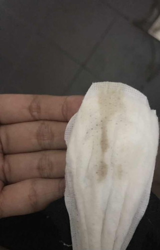 Brown discharge semasa 5 weeks hamil