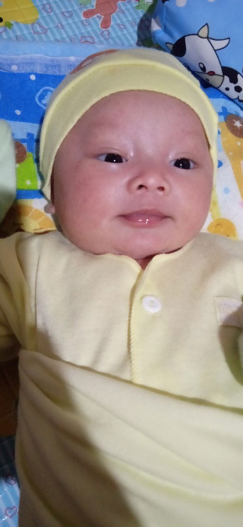 pipi bayi 2 bulan tembem sebelah