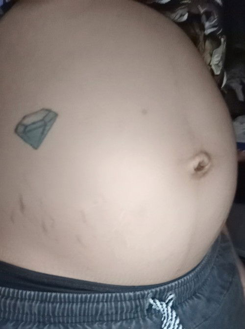 35 วีค✌🏻📌 ทายเพศกันค่ะ