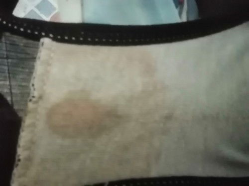 Normal lang po ba to 11 weeks pregnant