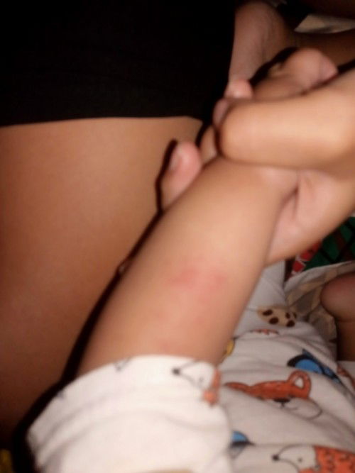 Umuulit po ba Ang Hand foot and mouth disease?🥺