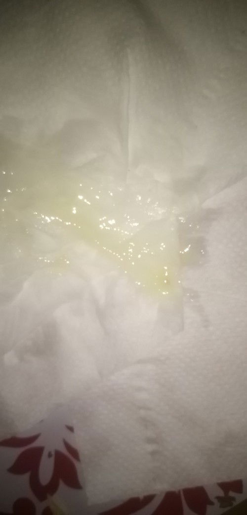 มีมูกออกปนเลือดนิดหน่อย