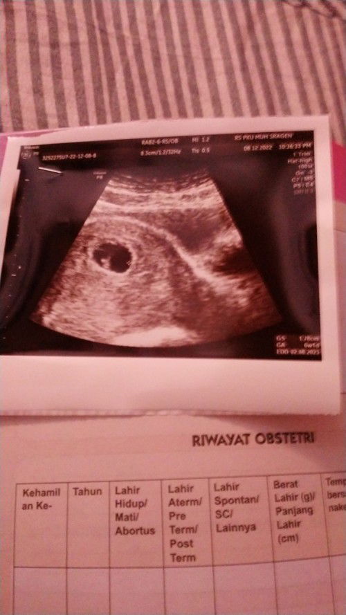 divonis BO di UK 9w2d karna flek