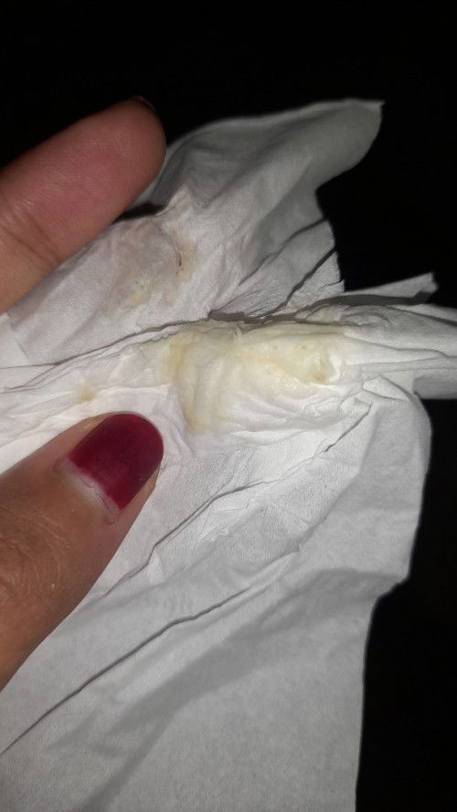 Keputihan saat hamil