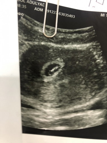 มีแม่ๆคนไหนเคยเป็นบ้างไหมค่ะ