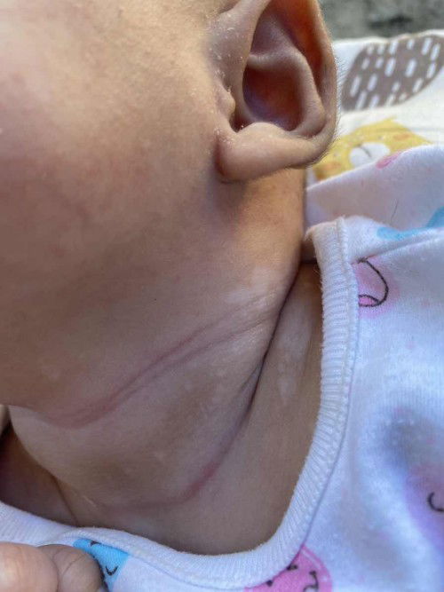 แบบนี้ใช้อะไรทาถึงหายคะ