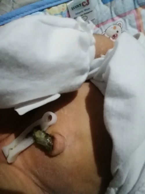 12 days palang si baby