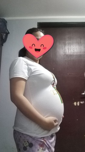 Malaki po ba sa 34 weeks ang tyan ko