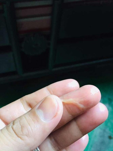 Hello sign po ba ito ng ovulation (check po sa photo) last mens ko po nung nov. 30