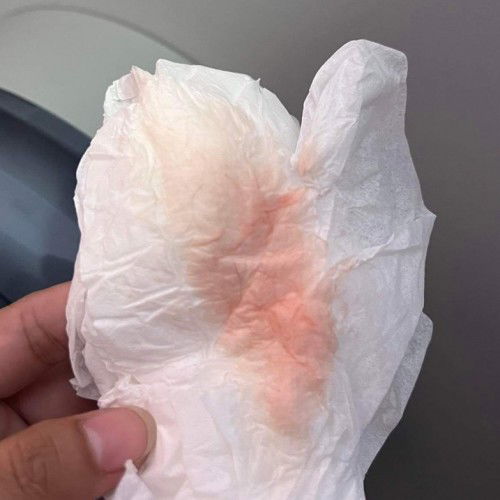 มีเลือดสีชมพูออกมา