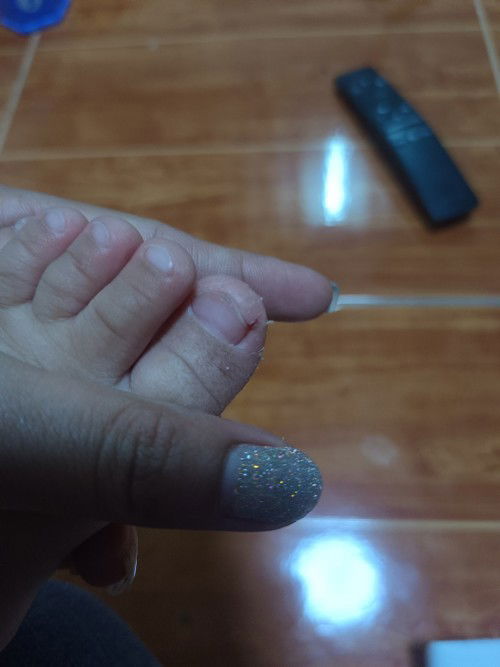 น้องนิ้วเท้าลอก มีจาตัวไหนแนะนำไหมคะ