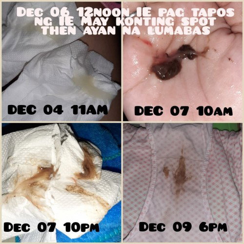 38 weeks and 3days
LMP DEC 23 2022
1ST ULTRASOUND DEC 20 2022
BPS DEC 21 2022
Last Dec 06 2-3cm