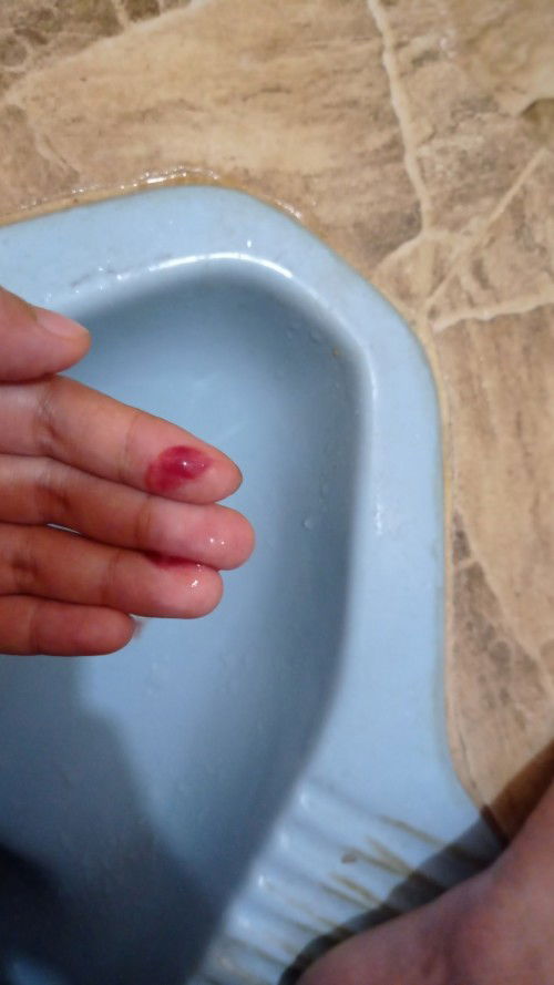 Keluar lendir di usia kehamilan 40 minggu