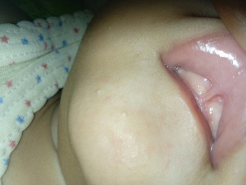 Liptie / bukan