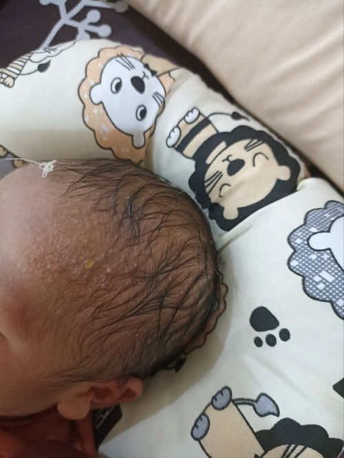 bayi ku umur 8 hari,tp muncul bintik2 merah berisi air di kepala dan dahi.boleh Share salep nya