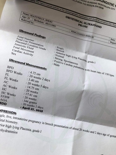 Fetal weight