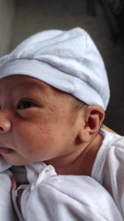 Sana po may mkasagot ..tnx po