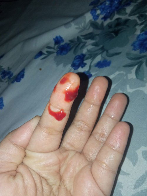 Hml 9 mg, setelah HB keluar spot darah selama 2 hari. Dikasih penguat, tp msh spotting.  Ada yg sma?