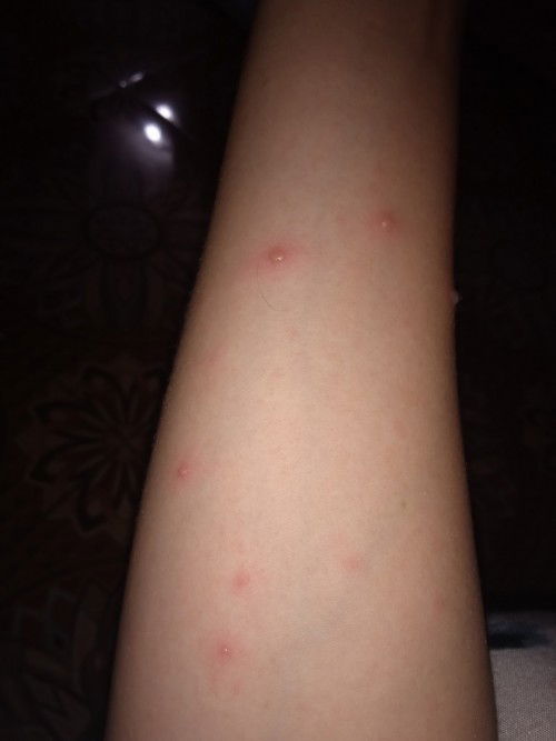 Sedikit cerita bunda
Butuh suport