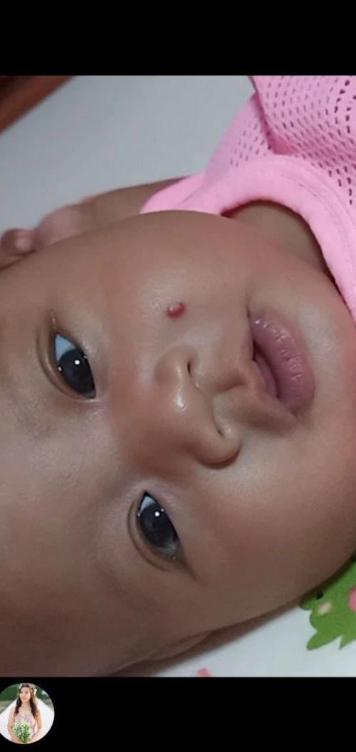 หน้าเป็นเลือดครั้ง