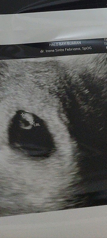 kemarin di vonis bo tp dokternya salah!❤️