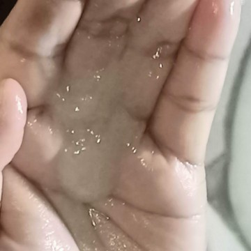 Normal poba ang white discharge 20weeks