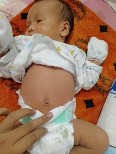 กลัวลูกมีภาวะรับน้ำนมมากเกินไป