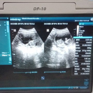 Bun mau tanya dong semenjak hamil Bunda²jadi pada susah tidur malam gak sih