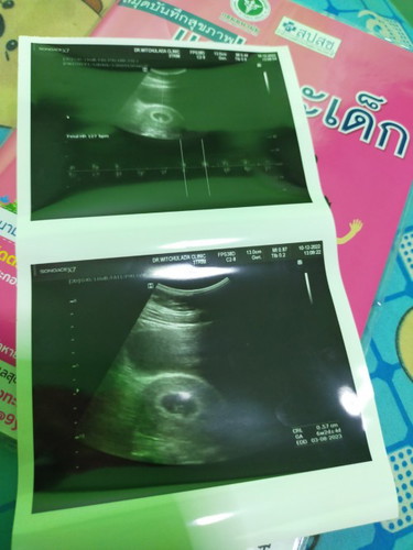 น้องมาแล้ววว🤍👶🏻🍼