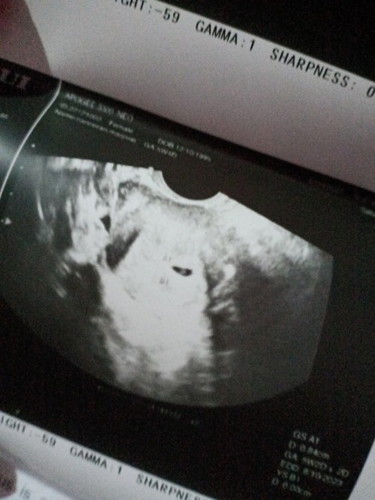 5 weeks and 2 days