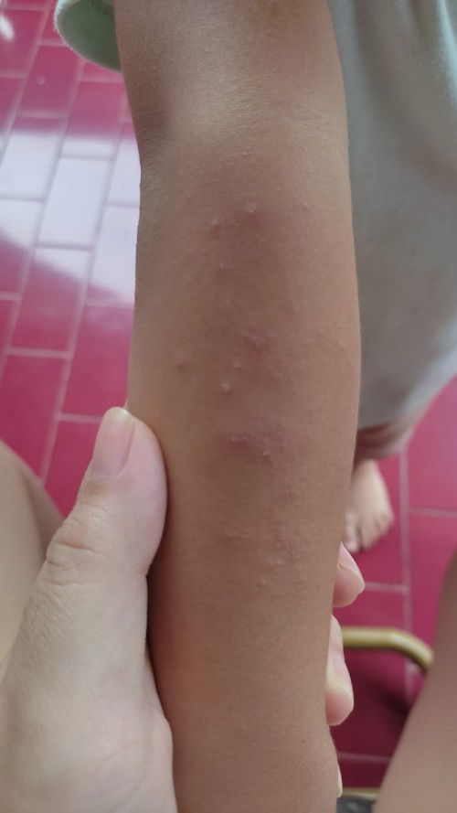 Adakah yg pengalaman anaknya begini ?