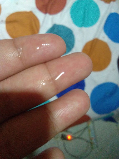 Puting ngeluarin cairan bening lengket karna lecet abis di bersiin pake baby oil padhl udah pelan2
