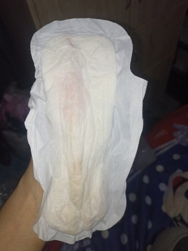 Watery discharge 30 weeks pregnant gumagalaw naman si baby ngaun