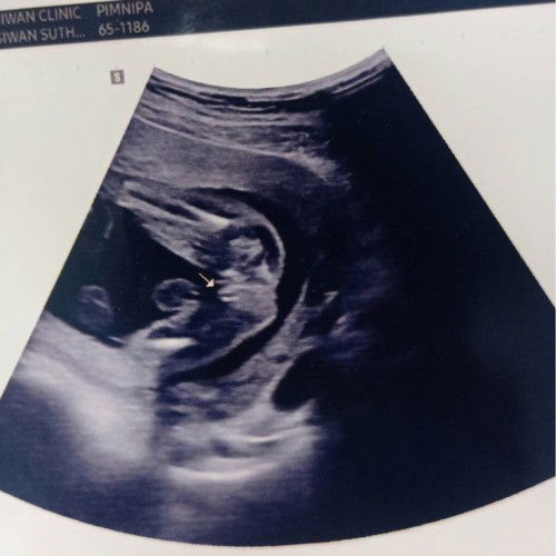 ผู้หญิงหรือผู้ชาย