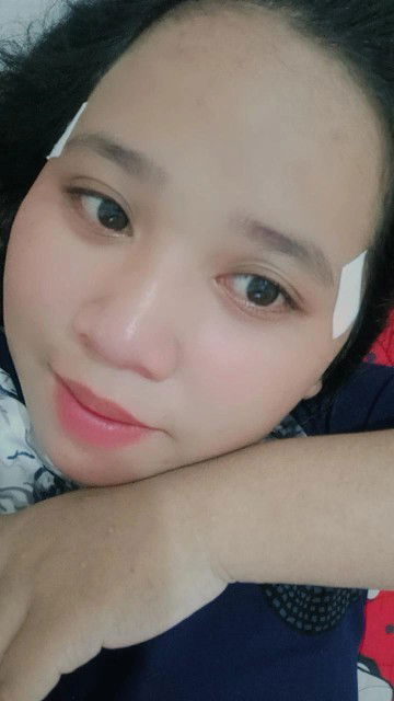 Tentang sakit perut bagian atas.