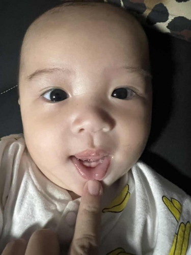 ฟันขึ้นแล้วคับ 👶🏻